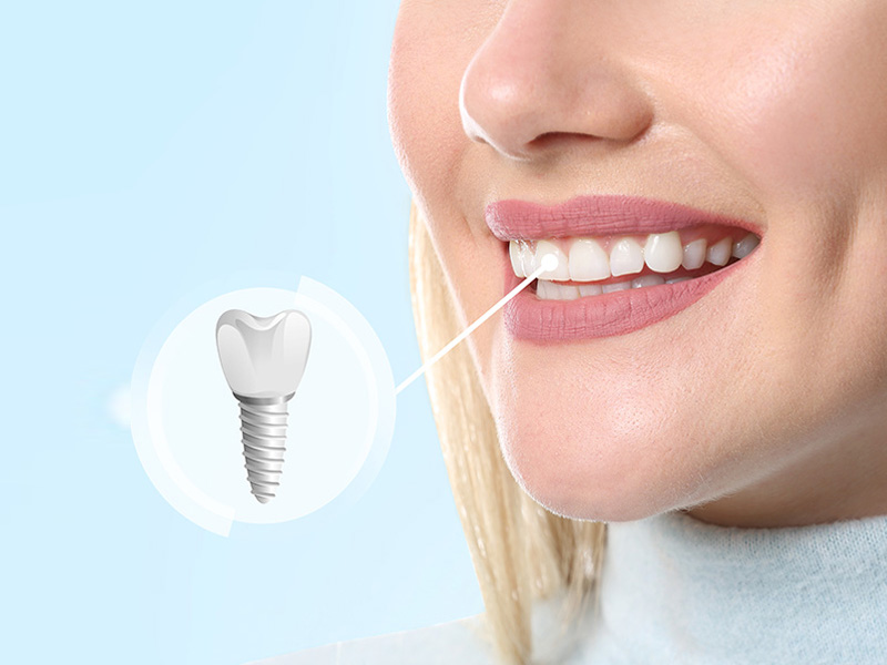 Simply Smiles Dental in Harlem | Cosmetic Dentistry, CEREC and Oral Exams