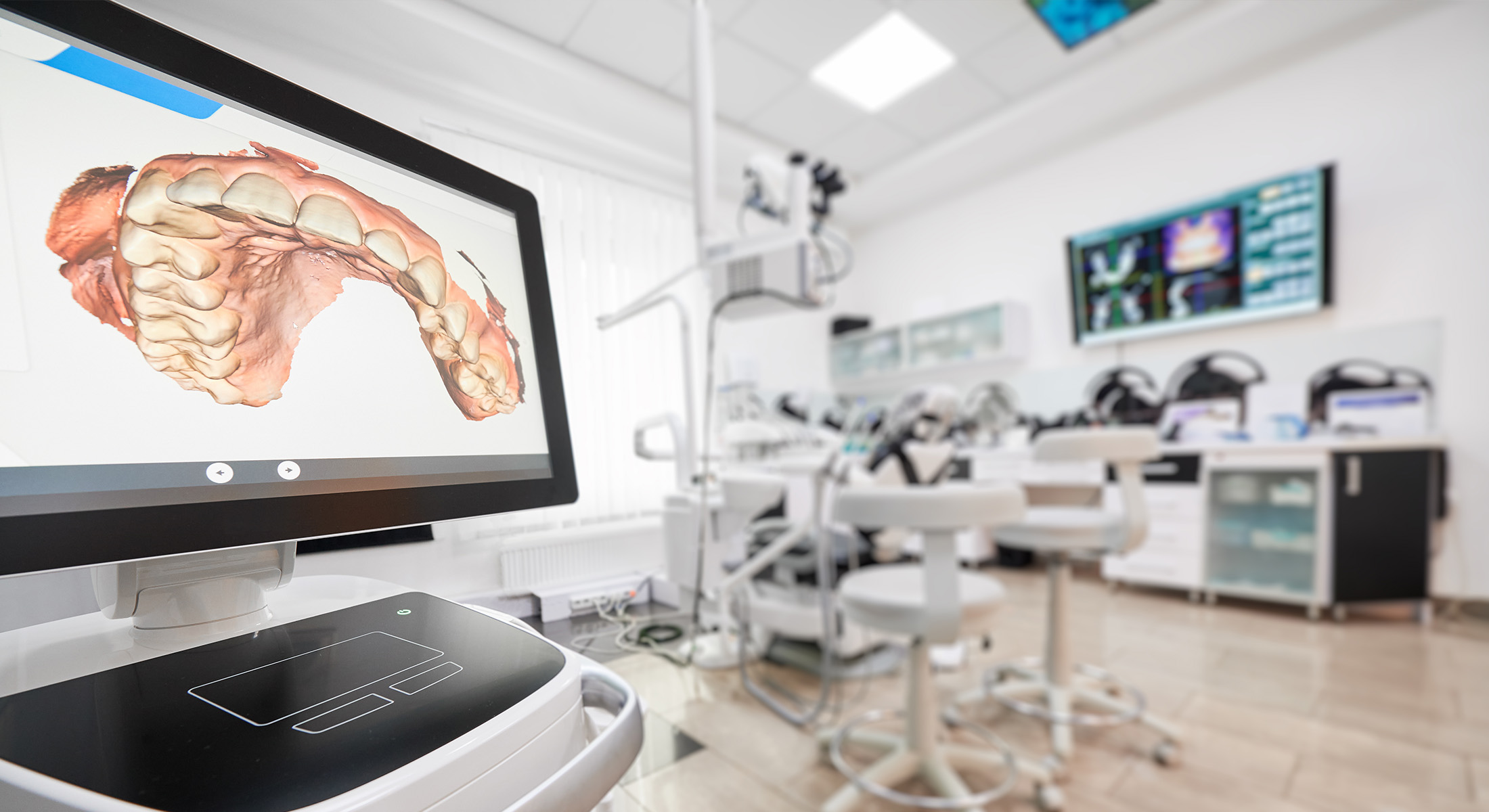 Simply Smiles Dental in Harlem | Oral Cancer Screening, Digital Impressions and Ceramic Crowns