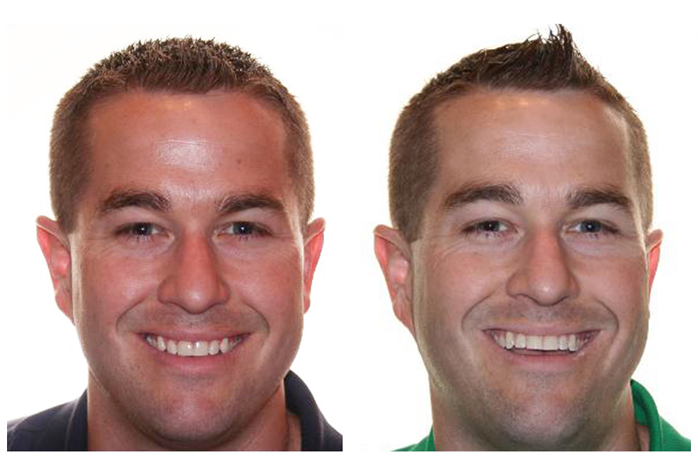 Simply Smiles Dental in Harlem