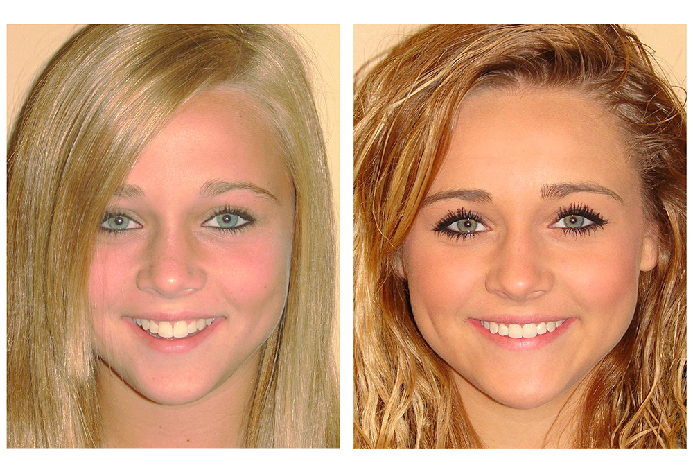 Simply Smiles Dental in Harlem