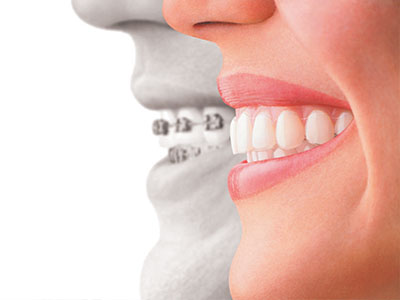 Simply Smiles Dental in Harlem | CEREC, Sports Mouthguards and LANAP reg 