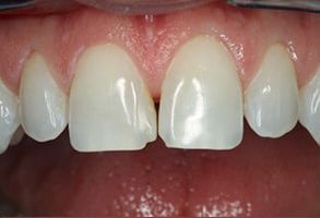 Simply Smiles Dental in Harlem | Dental Cleanings, CBCT and TMJ Disorders